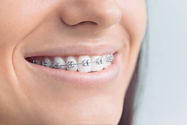 Best Invisalign and Clear Aligners  in Fort Lupton, CO